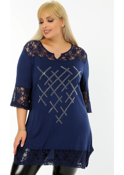 Önü Taş Baskılı Dantel Detaylı V Yaka Kısa Kol Yırtmaçlı Tunik