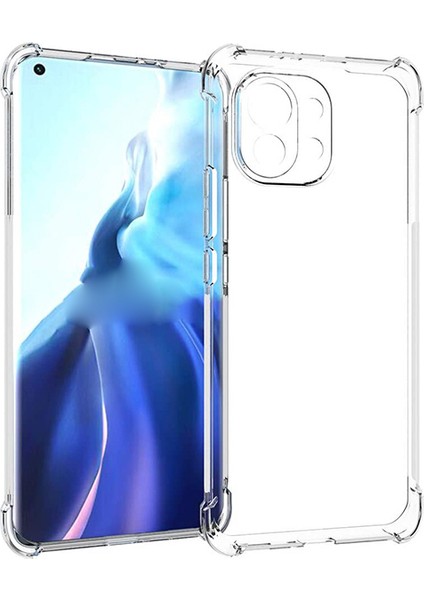 Xiaomi Mi 11 Kamera Korumalı Shockproof Darbe Emici Silikon Kılıf