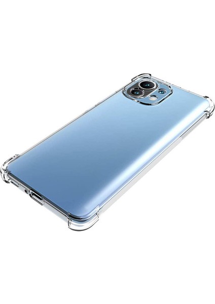 Xiaomi Mi 11 Kamera Korumalı Shockproof Darbe Emici Silikon Kılıf fırsatları