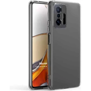Xiaomi Mi 11T Kılıf Transparent Soft Beyaz
