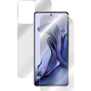 Ipg Xiaomi 11T - Mi 11T Tam Kaplama (Ekran ve Arka Koruma)
