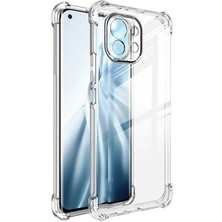 Case 4U Xiaomi Mi 11 Lite Kılıf Kamera Korumalı Darbe Emici Anti Shock Silikon Arka Kapak Şeffaf