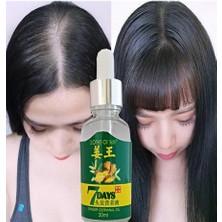 7Days 30ML Gingergerminalessentialoil Hair Growth Loss Treatment Serum Unisex Saç Bakım Yağı