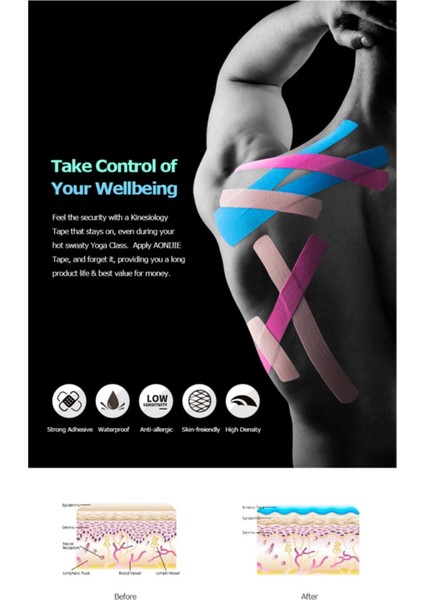 Kinesio Tape Crosstape Kinesio Ten Rengi 5cm x 5 M Sporcu Bandı