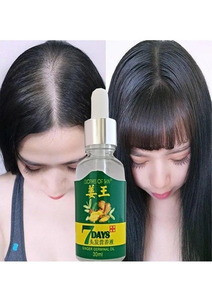 30ML Gingergerminalessentialoil Hair Growth Loss Treatment Serum Unisex 3 Adet Saç Bakım Yağı