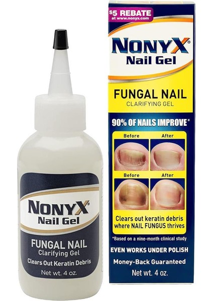 Nail Gel 113GR