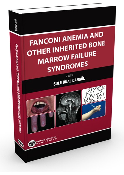 Fanconi Anemia And Other Inherited Bone Marrow Failure Syndromes - Şule Ünal Cangül