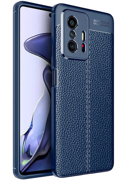 Caseworld Xiaomi Mi 11T Pro Kılıf Darbe Korumalı Deri Görünümlü Silikon Arka Kapak - Lacivert