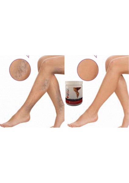 Varicose Vein Defense Cream Diz Bacak Bakım Kremi 200ml+50ml Ayak