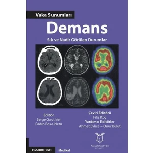 Demans Vaka Sunumları Sık ve Nadir Görülen Durumlar - Filiz Koç