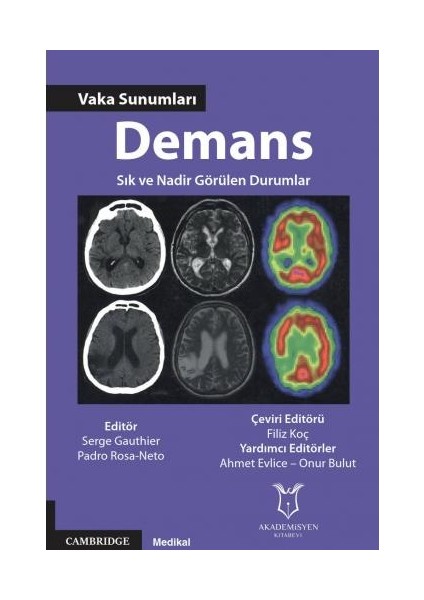 Demans Vaka Sunumları Sık ve Nadir Görülen Durumlar - Filiz Koç