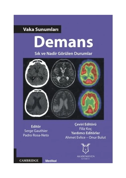 Demans Vaka Sunumları Sık ve Nadir Görülen Durumlar - Filiz Koç