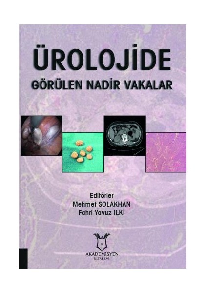 Ürolojide Görülen Nadir Vakalar - Mehmet Solakham