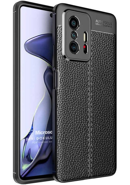 Xiaomi Mi 11T Pro Kılıf Deri Dokulu Silikon Siyah
