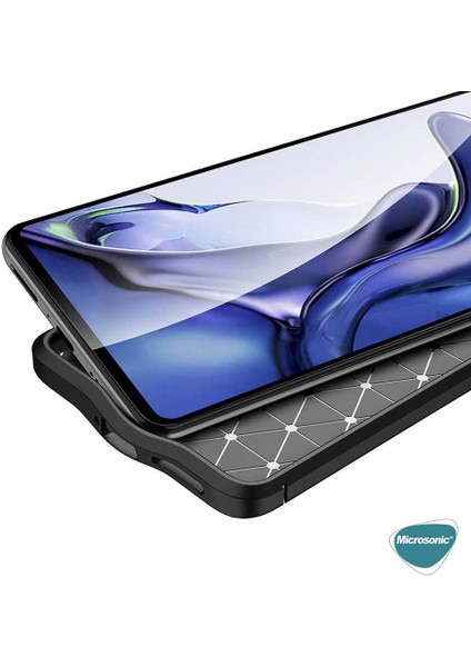 Xiaomi Mi 11T Pro Kılıf Deri Dokulu Silikon Siyah indirimleri