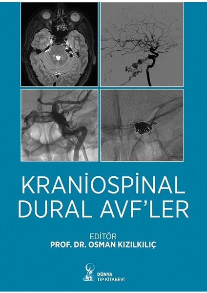 Kraniospinal Dural Avf’ler - Osman Kızılkılıç (Ciltli)