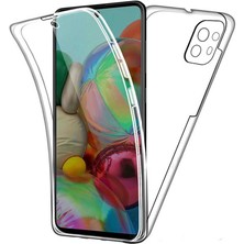 Smody Xiaomi Mi 11 Lite Kılıf Ön Arka Şeffaf Silikon 360 Enjoy