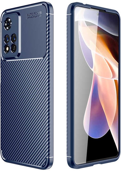 Xiaomi Redmi Note 11 Pro Kılıf Negro Karbon Görünüm Kamera Korumalı Silikon+Nano Glass Lacivert