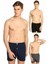 Düğmeli Erkek Boxer 3'lü Paket 3