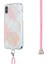 2.0mm Imd Tpu Telefon Kılıf + Ipi Ekleme Mermer Desen Galvaniyeli Ultra Slim Durumda iPhone x / Xs 5.8 Inç - Pembe / Beyaz (Yurt Dışından) 3