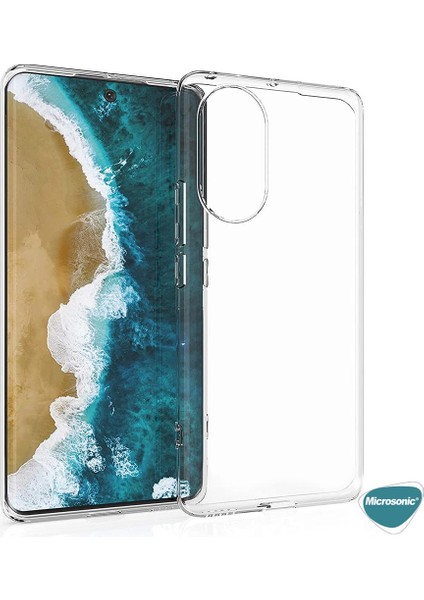 Huawei Nova 9 Kılıf Transparent Soft Beyaz