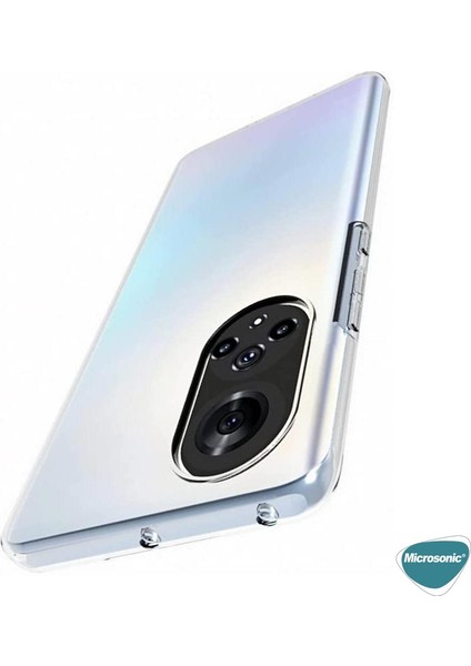 Huawei Nova 9 Kılıf Transparent Soft Beyaz