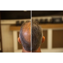 Fixplant 28 gr Saç Saç fiberi - Saç gürleştirici - Saç tozu - Siyah