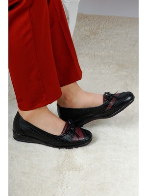 The Hope Shoes Kadın Topuk Dikenine Özel Ortopedik Deri Taban Anne Ayakkabısı