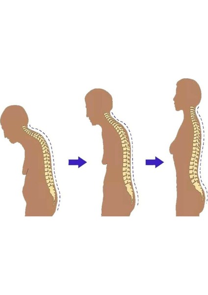 Ankaflex Medikal Ortopedik Dik Durus Korsesi Sırt Bel Doğru Duruş Aparatı Balenli Korse