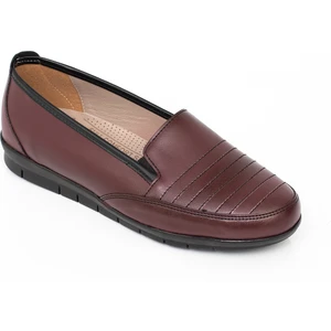 The Hope Shoes Kadın Topuk Dikenine Özel Ortopedik Günlük Anne Ayakkabısı