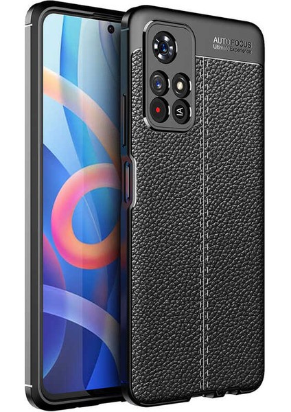 Caseworld Xiaomi Poco M4 Pro Kılıf Darbe Korumalı Deri Görünümlü Silikon Arka Kapak - Siyah