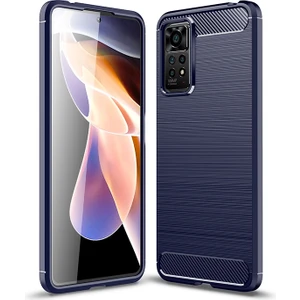 Redmi 11 Pro Için Fırçalanmış Tpu Telefon Kılıfı - Siyah (Yurt Dışından)
