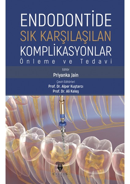 Endodontide Sık Karşılaşılan Komplikasyonlar