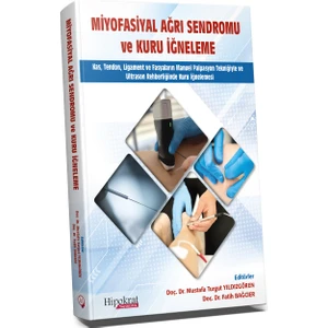 Miyofasiyal Ağrı Sendromu ve Kuru İğneleme