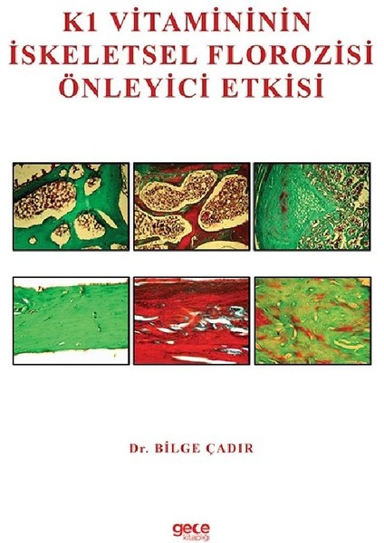 K1 Vitamininin Iskeletsel Florozisi Önleyici Etkisi