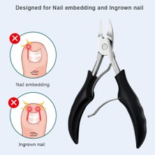 Sanlindou 10 Adet Pedikür Araçları Profesyonel Ayak Bakımı Kiti Balgrown Toenail Temizleme Düzeltme Clippers Toe Tail Dosya Kaldırıcı Tırnak Tedavi | Ayak Bakım Aracı (Yurt Dışından)