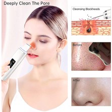 Sanlindou Cilt Scrubber Cilt Spatula Blackhead Remover Gözenek Temizleyici Çok Amaçlı Derin Temizleme Için Yüz Komedon Extractor | Cilt Scrubber (Mor) (Yurt Dışından)