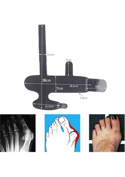 Bunyon Düzeltici Toe Düzleştirici Destek Toes Ayak Başparmak Ortez Halluks Düzeltici Ortopedik Aletleri 2 Adet 1 Çift | Ayak Bakım Aracı (Yurt Dışından)