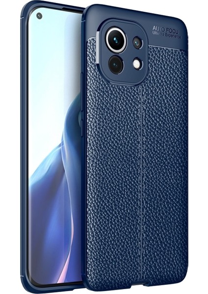 Xiaomi Mi 11 Kılıf (Yurt Dışından)