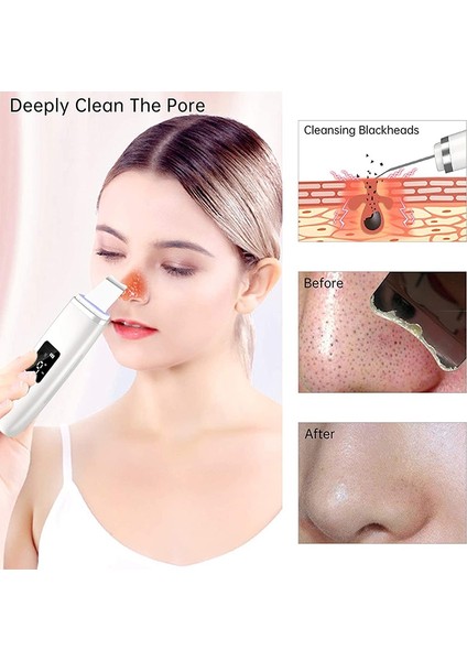 Cilt Scrubber Cilt Spatula Blackhead Remover Gözenek Temizleyici Çok Amaçlı Derin Temizleme Için Yüz Komedon Extractor | Cilt Scrubber (Mor) (Yurt Dışından) fiyatları