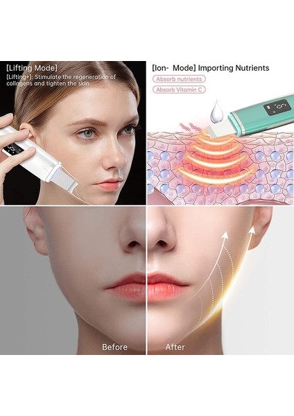 Cilt Scrubber Cilt Spatula Blackhead Remover Gözenek Temizleyici Çok Amaçlı Derin Temizleme Için Yüz Komedon Extractor | Cilt Scrubber (Mor) (Yurt Dışından) modelleri