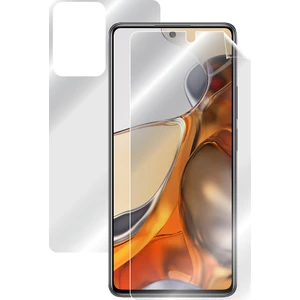 Ipg Xiaomi 11T Pro Tam Kaplama (Ekran ve Arka Koruma)