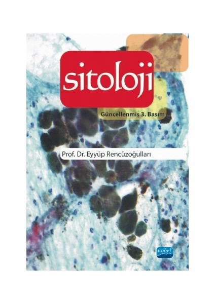 Sitoloji