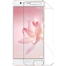 IPG Huawei P10 Plus Görünmez Ekran Koruyucu