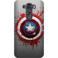 Kapakolur LG G3 Mini Kabartmalı Kaptan Temalı Kapak Kılıf