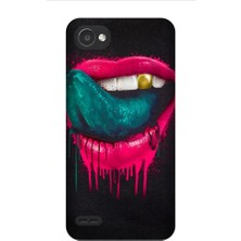 Kapakolur LG Q6 Ultra Altın Diş Baskılı Kapak Kılıf + Ekran Koruyucu Cam