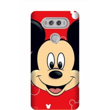 Kapakolur LG V20 Mickey Kapak Kılıf + Ekran Koruyucu Cam
