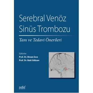 Serebral Venöz Sinüs Trombozu