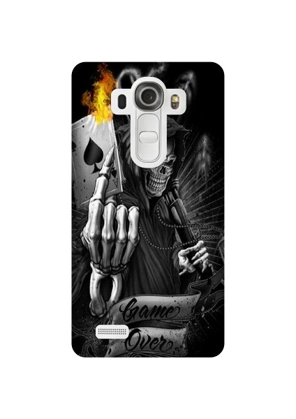 LG G4 Game Over Kapak Kılıf + Ekran Koruyucu Cam