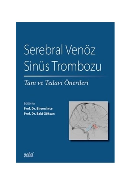 Serebral Venöz Sinüs Trombozu